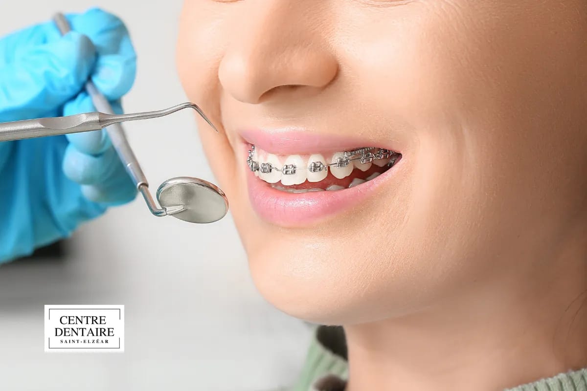 Comment la bouche produit la parole : dents, mâchoires et langue en action