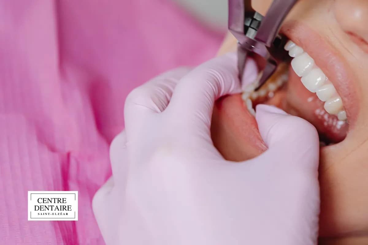 Déroulement d'un traitement orthodontique préventif à Laval