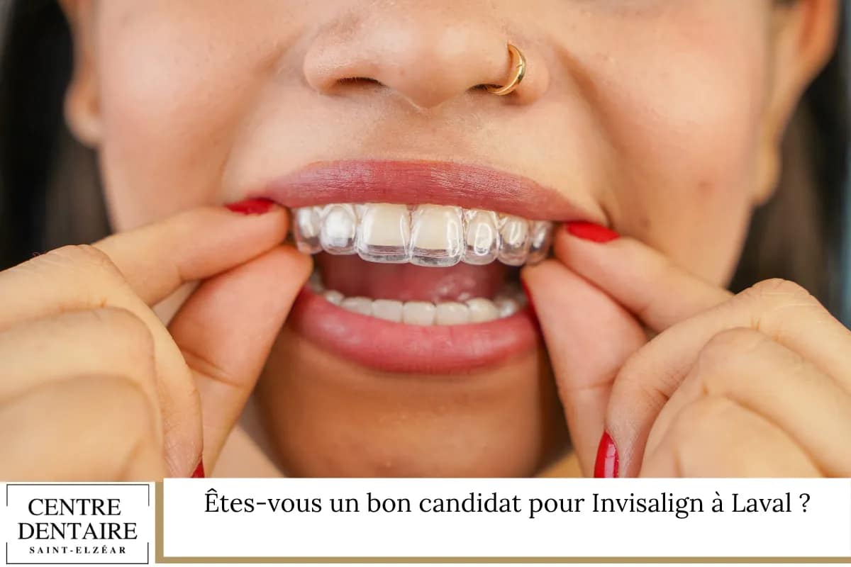 Êtes-vous un bon candidat pour Invisalign à Laval ?
