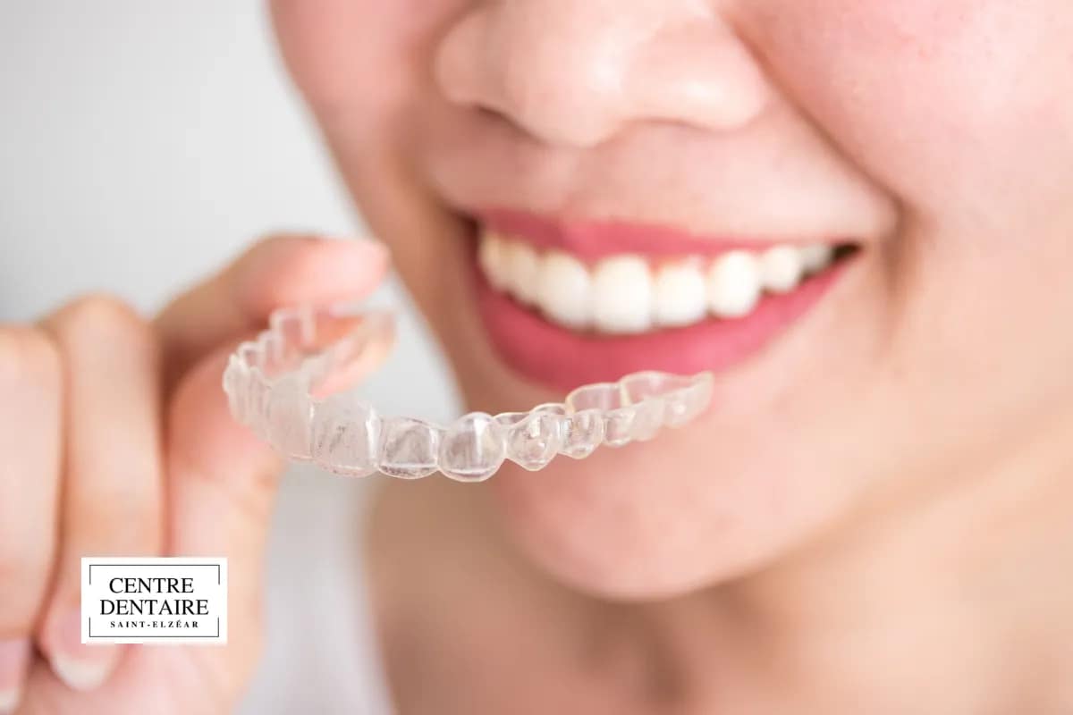 Responsabilité et mode de vie : êtes-vous prêt pour l'engagement Invisalign ?