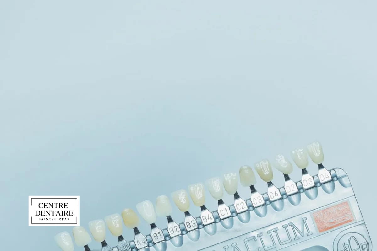 Blanchiment des dents et rôle de l'hygiéniste dentaire à Laval : ce que dit la loi