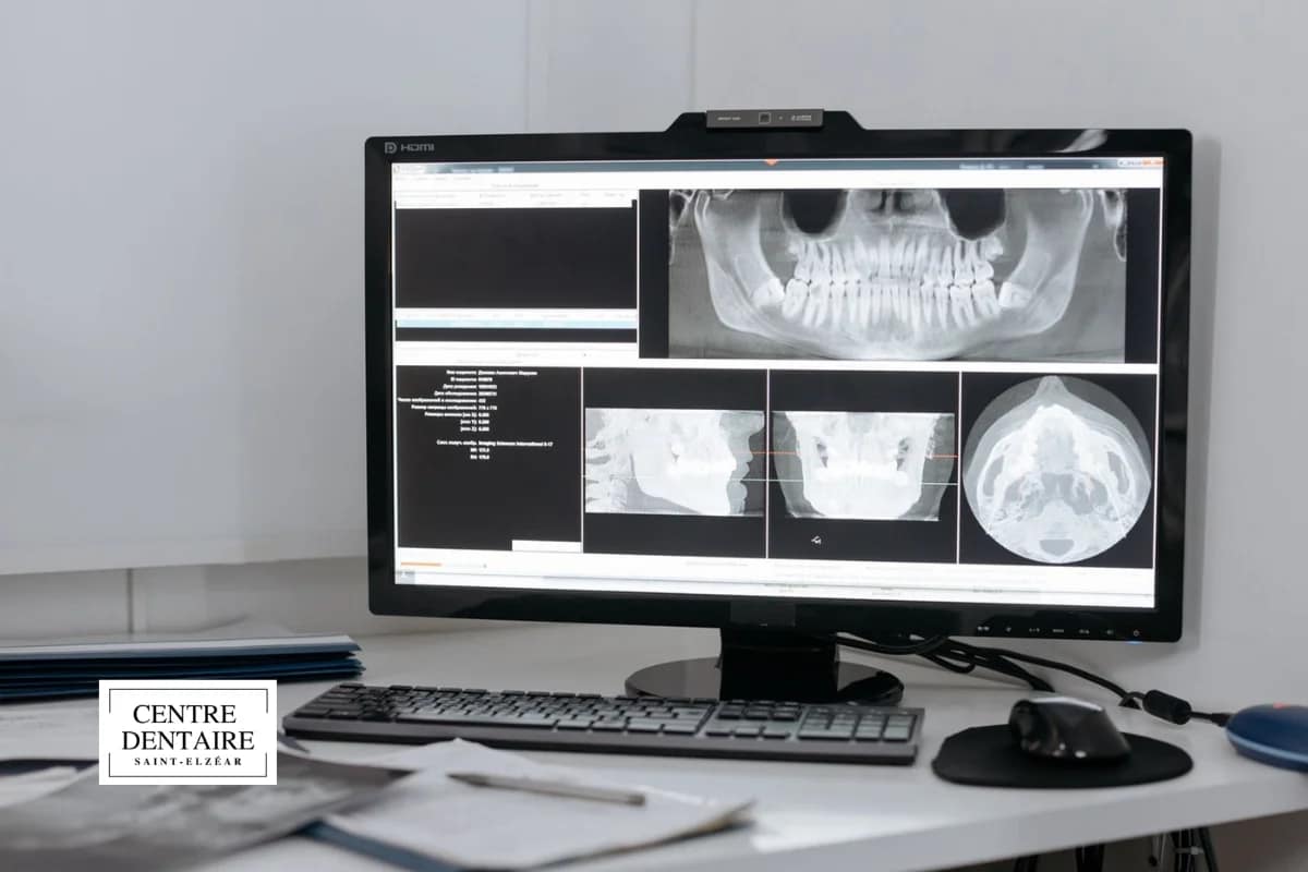 Causes fréquentes de la sous-occlusion chez les patients de Laval