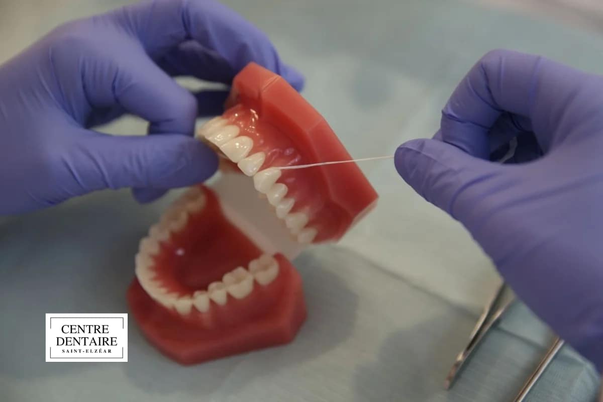 Ce qu'un hygiéniste dentaire peut faire concrètement pour blanchir ou éclaircir vos dents