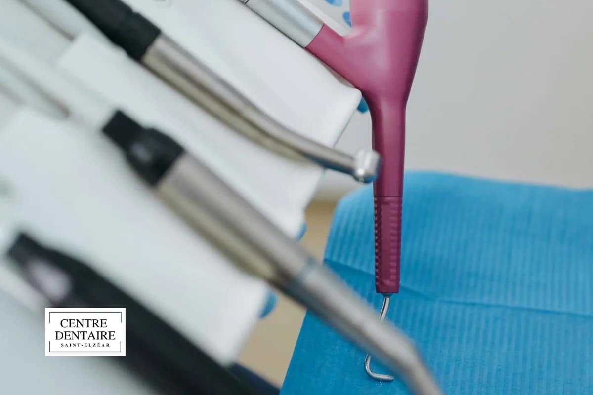 Déroulement d'un rendez-vous de blanchiment des dents en clinique dentaire à Laval