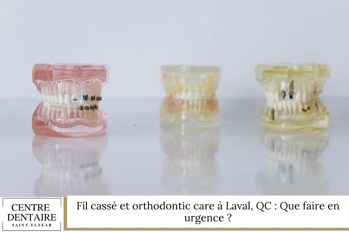 Fil cassé et orthodontic care à Laval, QC : Que faire en urgence ?