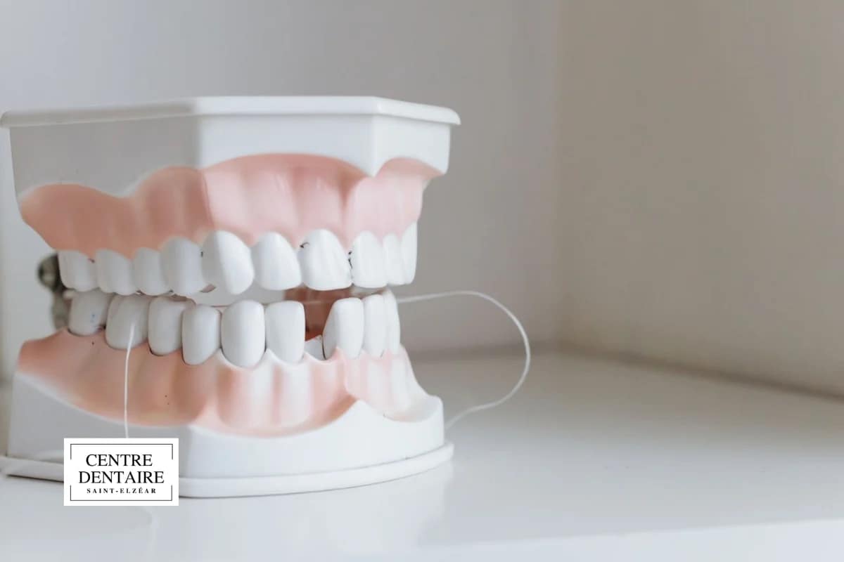 Fréquence « standard » des visites chez l'hygiéniste dentaire à Laval