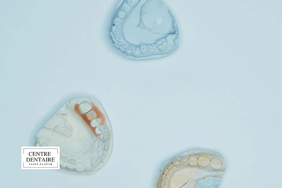 Préserver son nouveau sourire après un traitement d'orthodontie à Laval