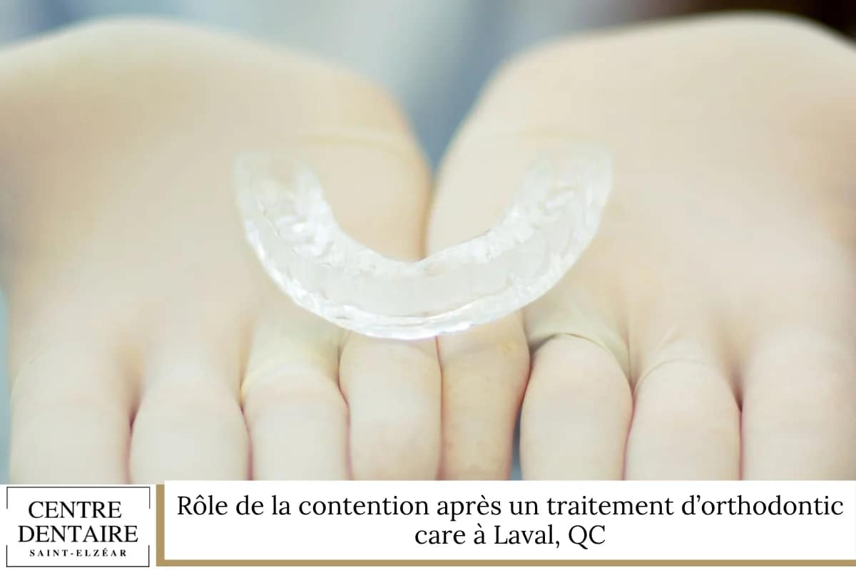 Rôle de la contention après un traitement d'orthodontic care à Laval, QC