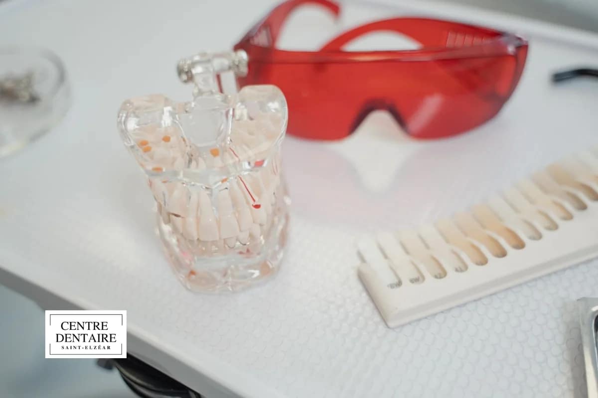 Rôle de votre dentiste à Laval dans le suivi de la contention