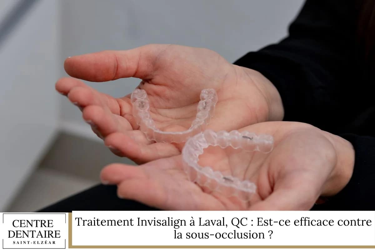 Traitement Invisalign à Laval, QC : Est-ce efficace contre la sous-occlusion ?