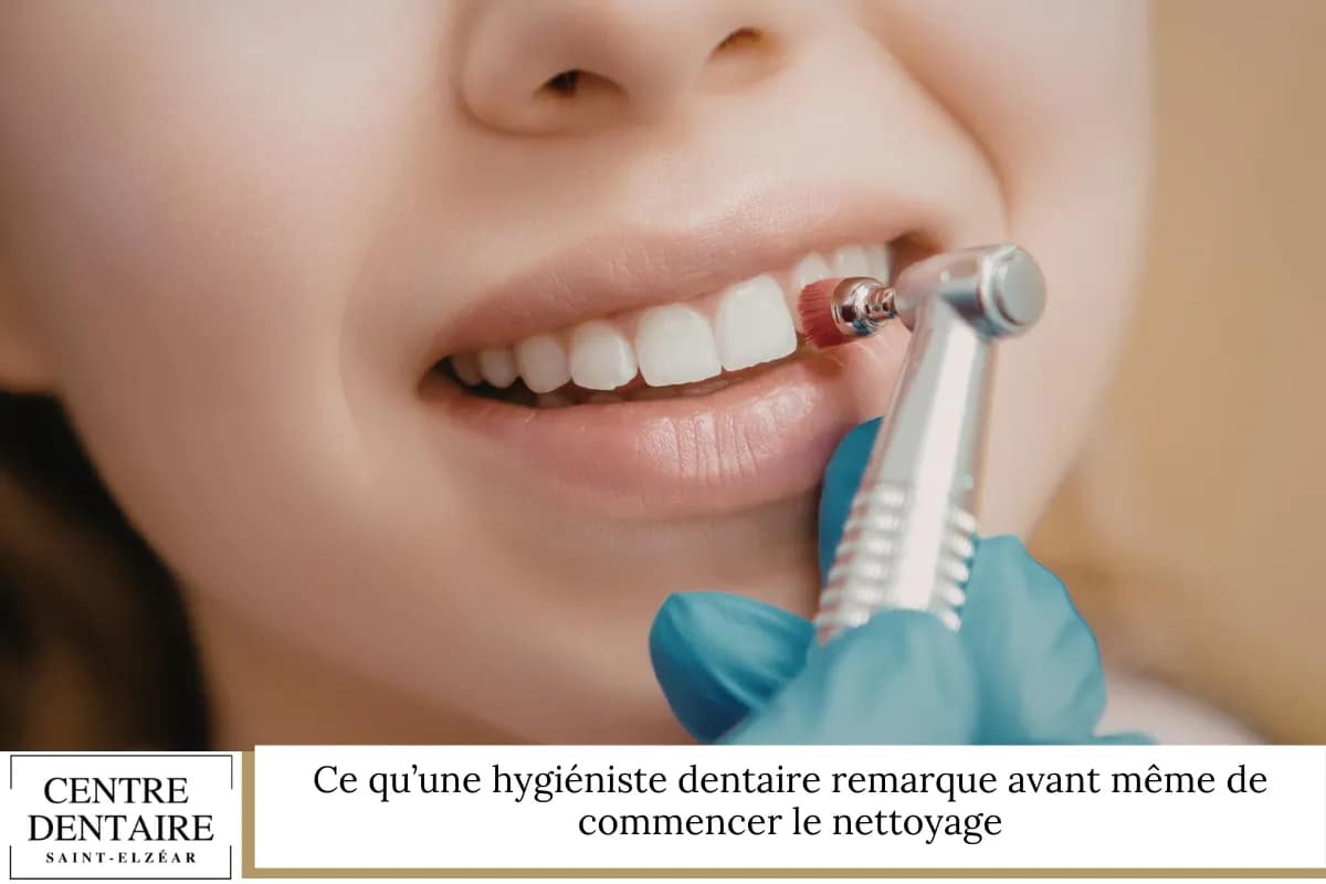 Ce qu’une hygiéniste dentaire remarque avant même de commencer le nettoyage