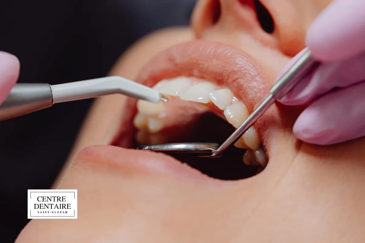 Comment tirer le maximum de son rendez-vous avec un hygiéniste dentaire à Laval
