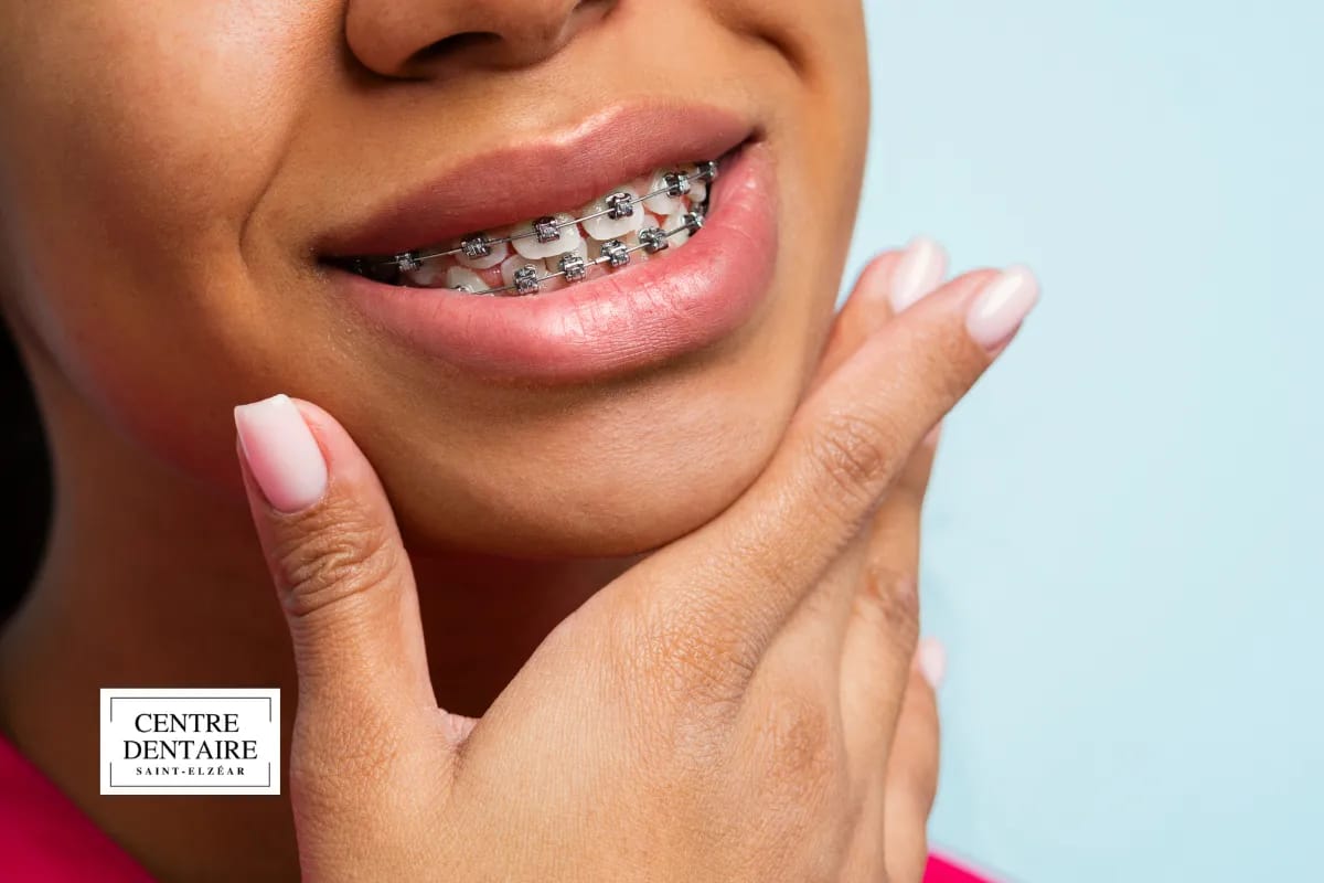 Les principaux traitements orthodontiques disponibles à Laval
