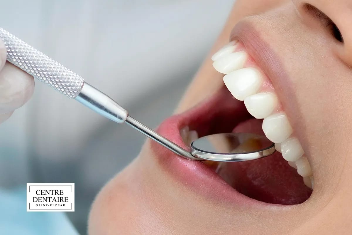 Que fait concrètement l'hygiéniste dentaire lors d'un rendez-vous à Laval ?